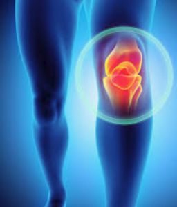 Runners Knee, or Patellofemoral Pain Syndrome, is a pain around the ...