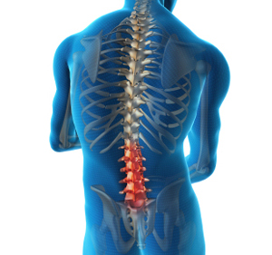 back pain treatment surry hills