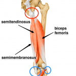 proximal hamstring tendinopathy - treatment surry hills, sydney