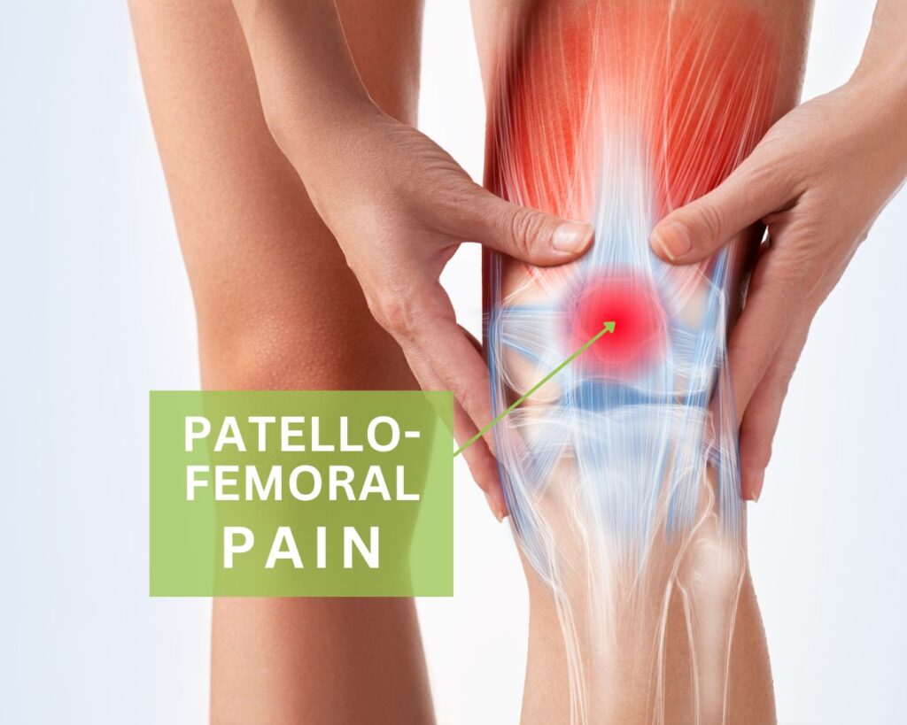 What causes knee pain with running - patellofemoral pain_Running Physio Sydney