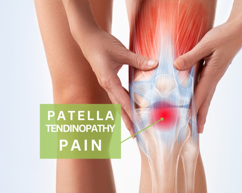 What causes knee pain with running - patella tendinopathy pain_Running Physio Sydney